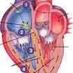 Electrical System of Heart Treatment In India