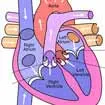 Heart Valve Replacement Surgery In India, Valve Surgeries Cost In India