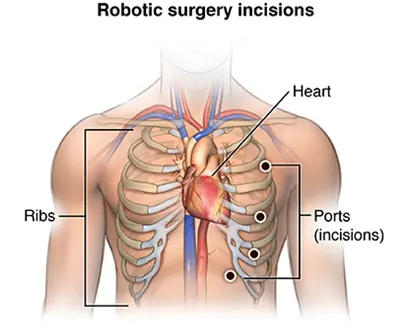 best hospital for robotic surgery in India, centre for robotic surgery in India
